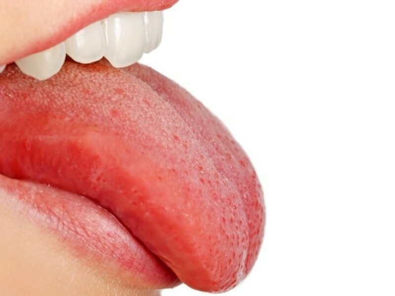 Червоні плями язика у дорослих та дітей: що робити?
